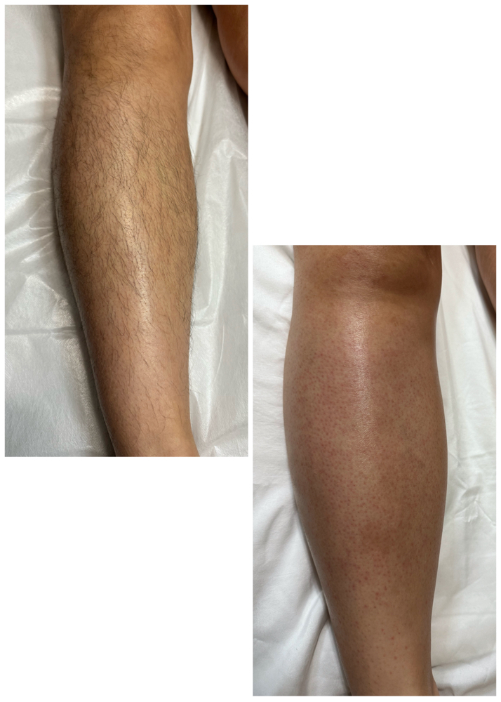 Full Leg Wax