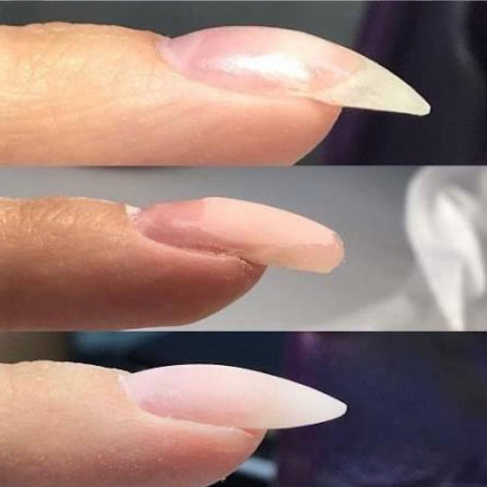Downward Nail Correction (Per Nail)