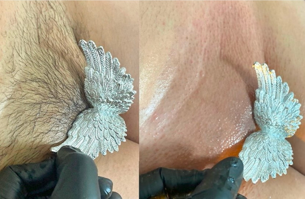 VIP Brazilian Wax