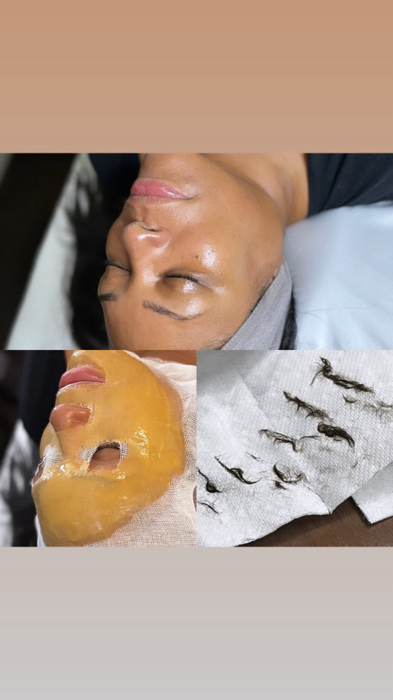 Dermaplanning Facial