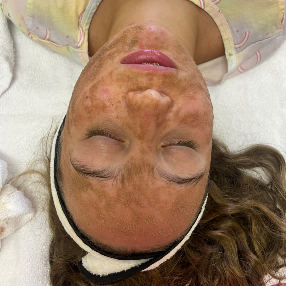 First Glow Facial (ages 8-12) at Honey Glow Esthetics in Norwalk, CA