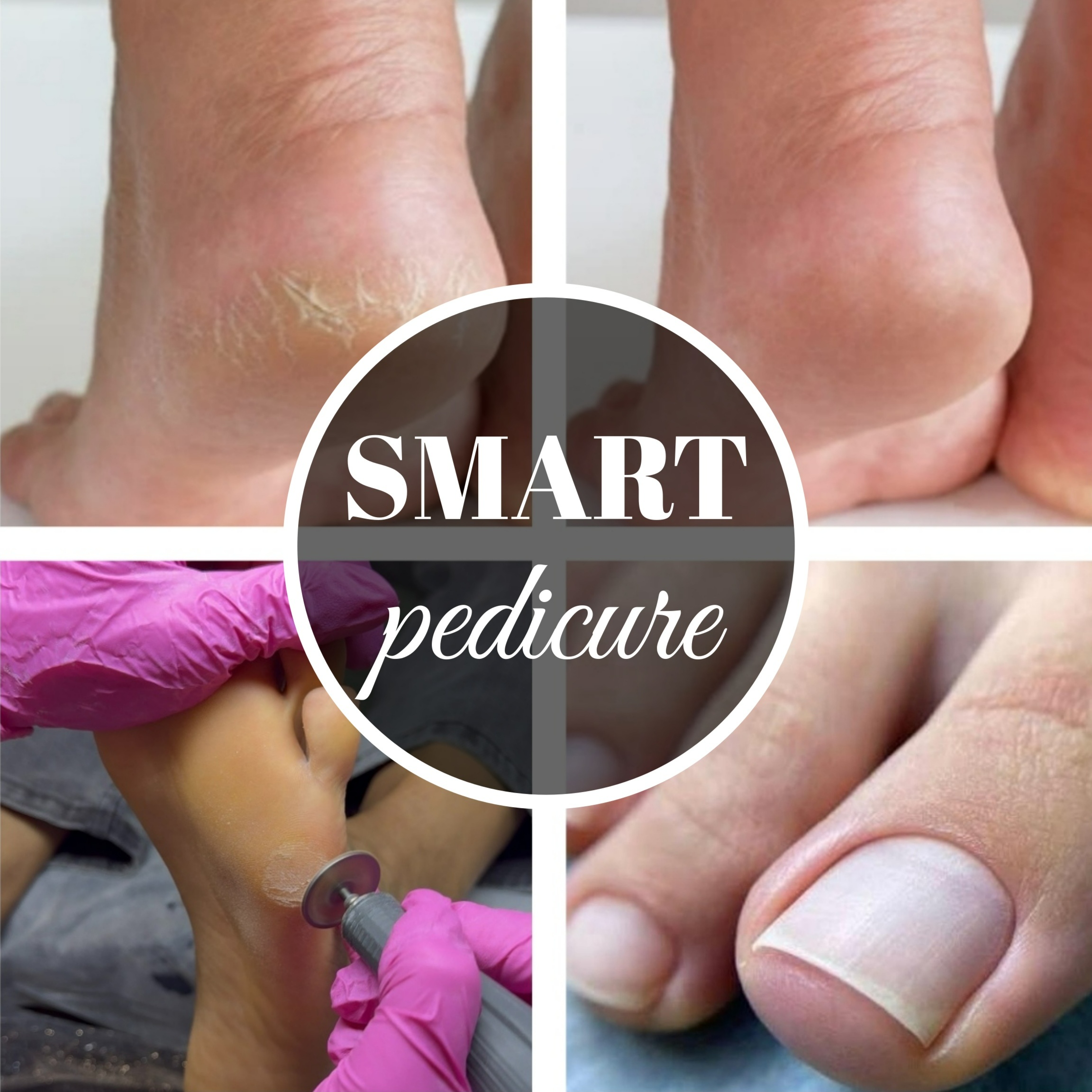 Smart Pedicure/No Gel/Specialist