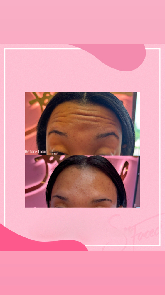 Wrinkle Relaxer $11/ Unit