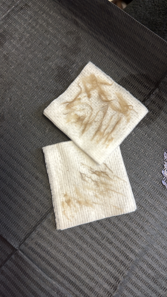 dermaplane service only