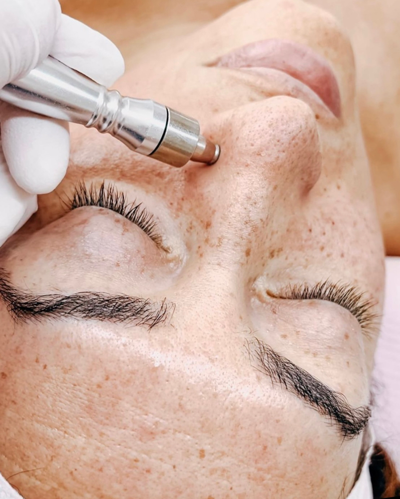 Diamond Brasion