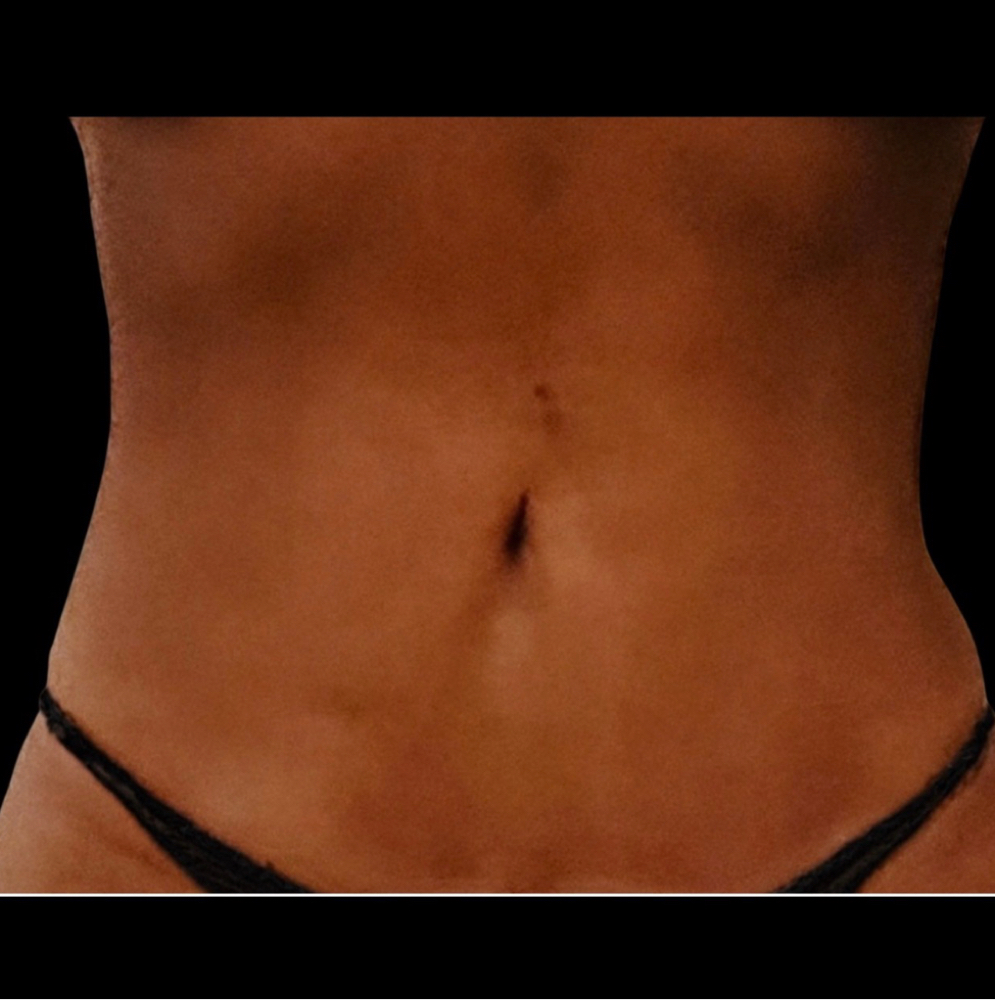 EM Shape Core Sculpt Series (6) at Styled Studio in Schenectady, NY