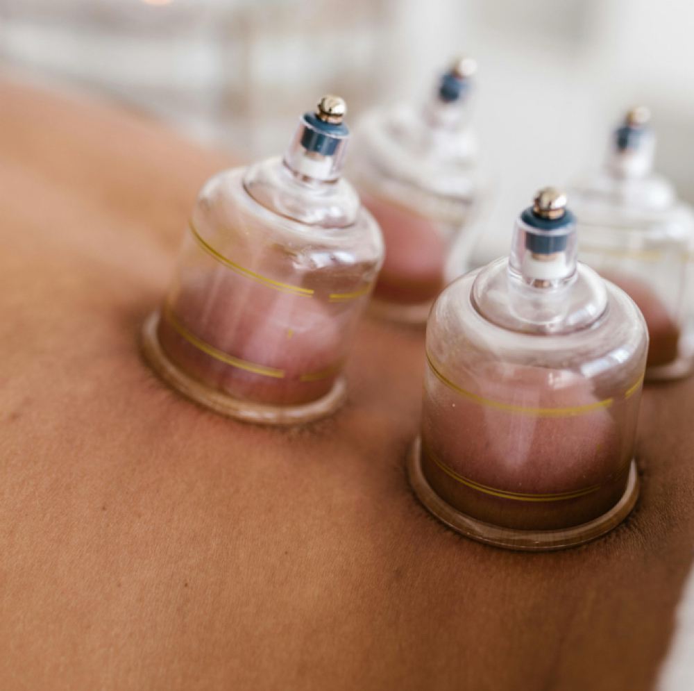 +Cupping Therapy at Remedy Restorative Wellness in Wilmington, DE