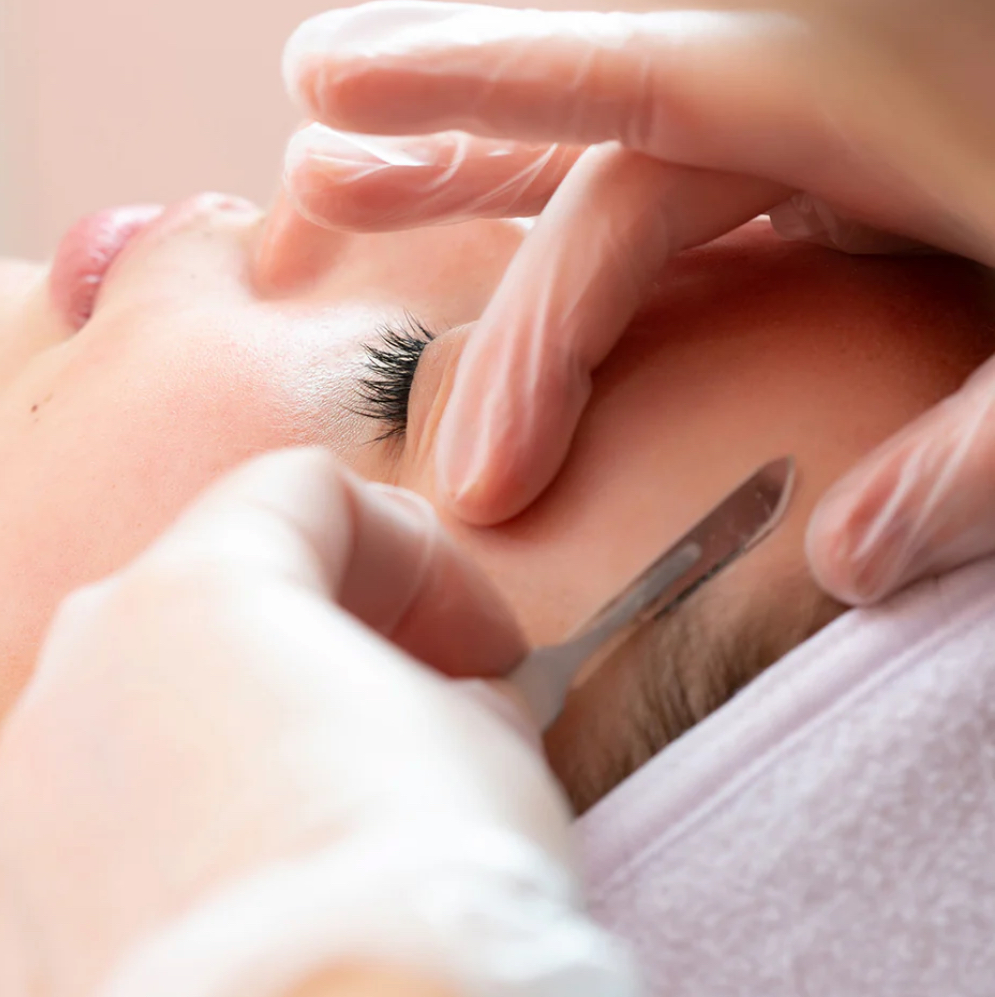 Dermaplaning