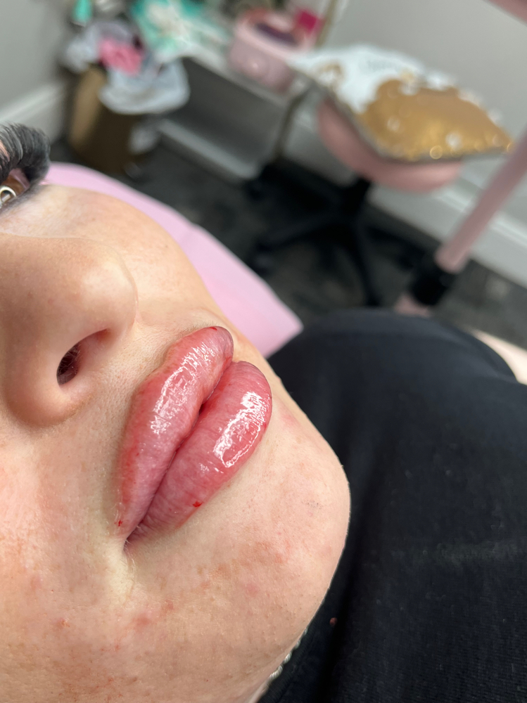 💋Refill Full Syringe 💋