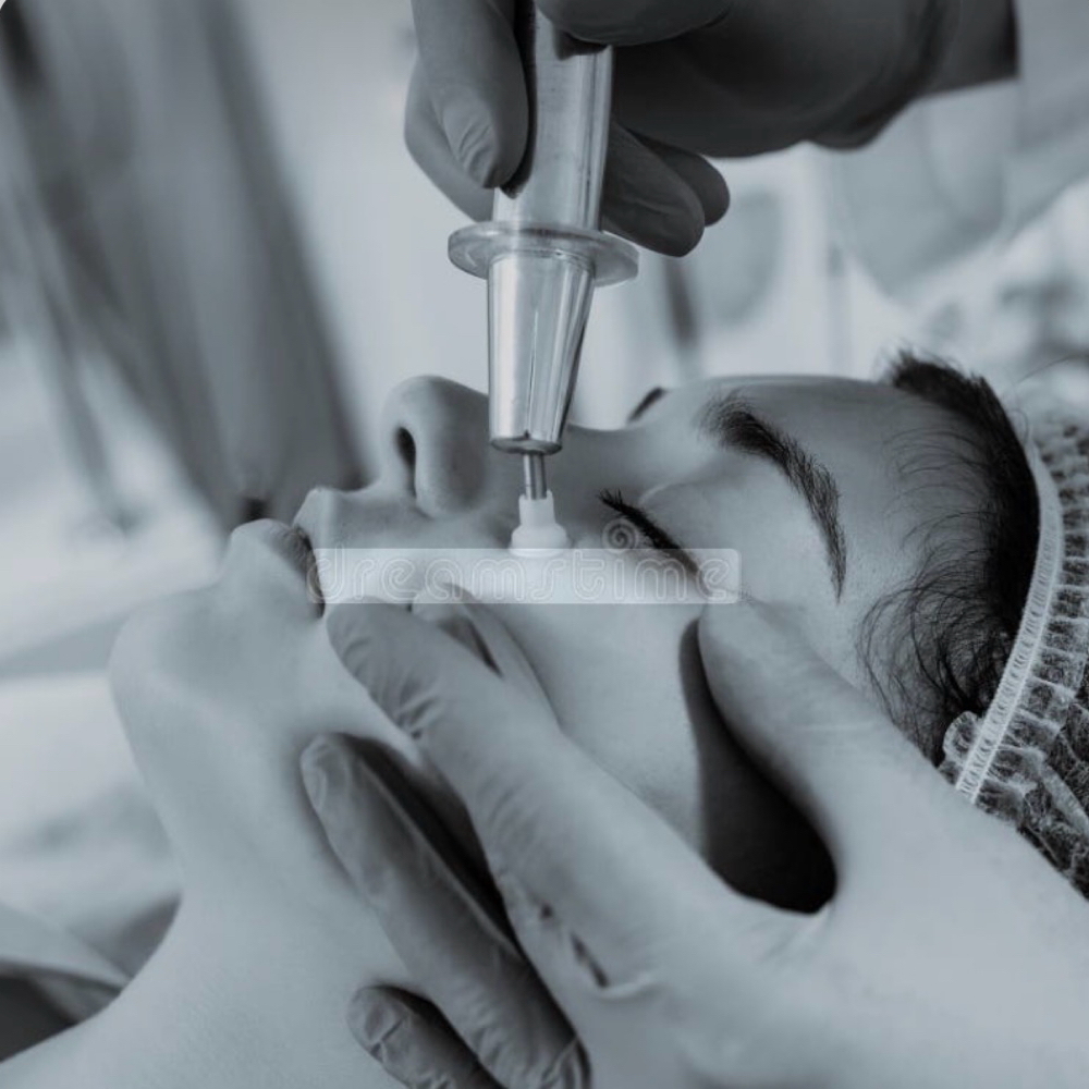 Microdermabrasion at Goddess Glow Esthetics in Houston, TX