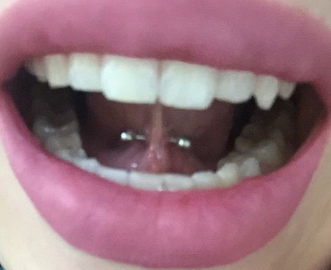 Tongue Web Piercing