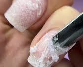 Artificial Nail Removal (our Work)