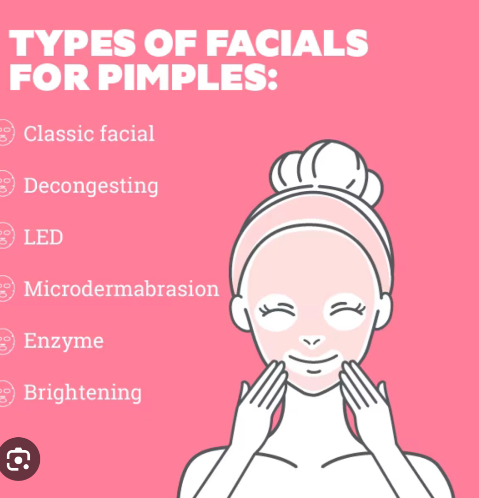 Acne Facial