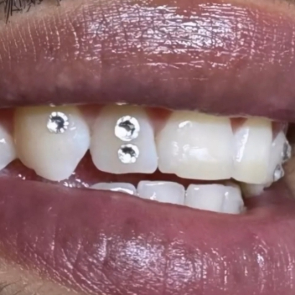 Additional Round Tooth Gems at Teeth Whitening Lounge in Santa Ana, CA