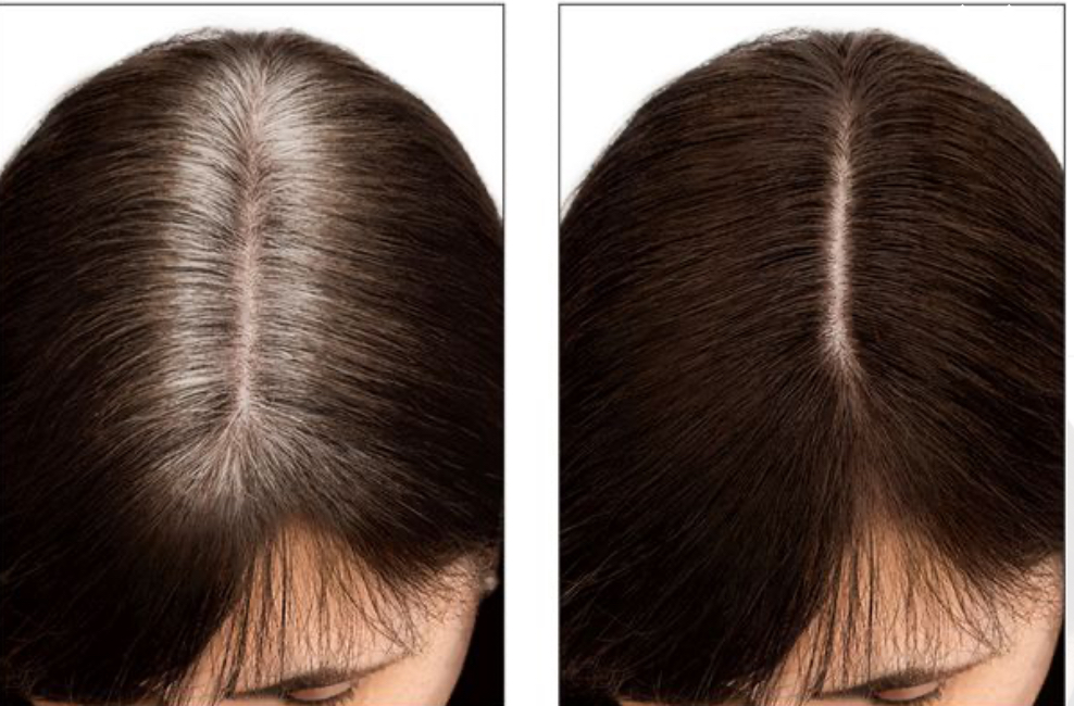 Root Touch Up