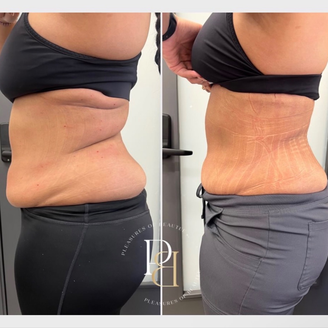 All-Inclusive 360 Package at Pleasures of Beautee in Atlanta, GA