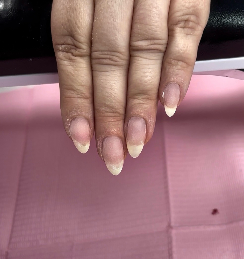 Acrylic Removal