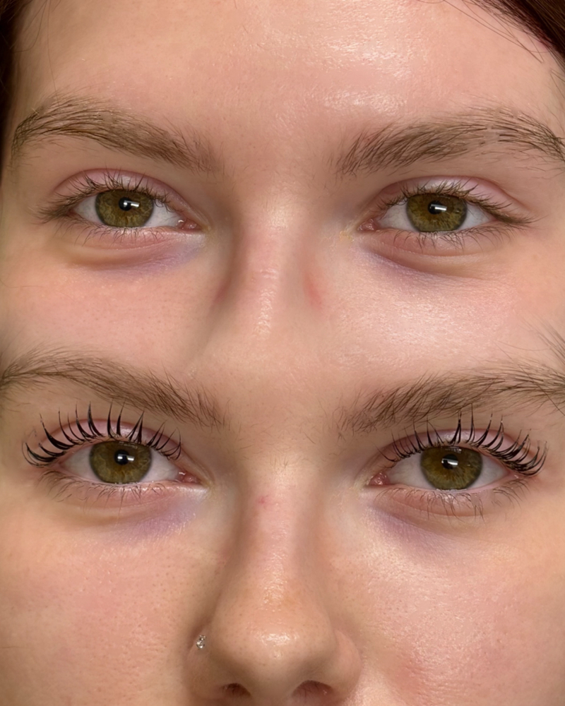 Lash Lift