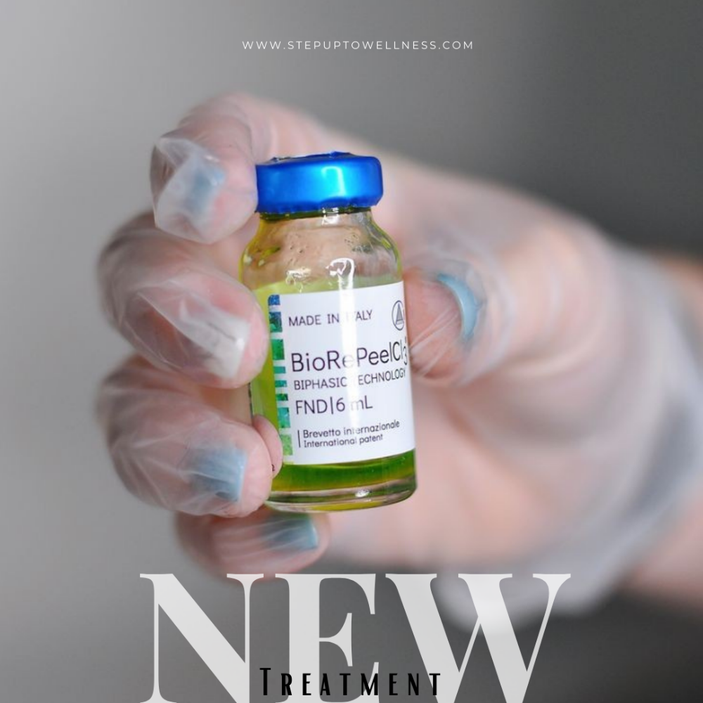 BioRePeel- 35%TCA Peel