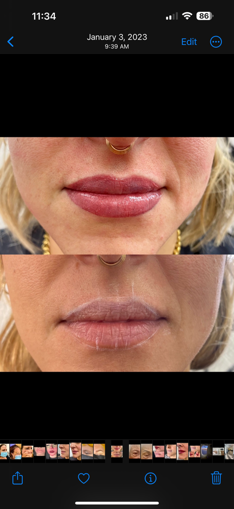 Lip Blushing