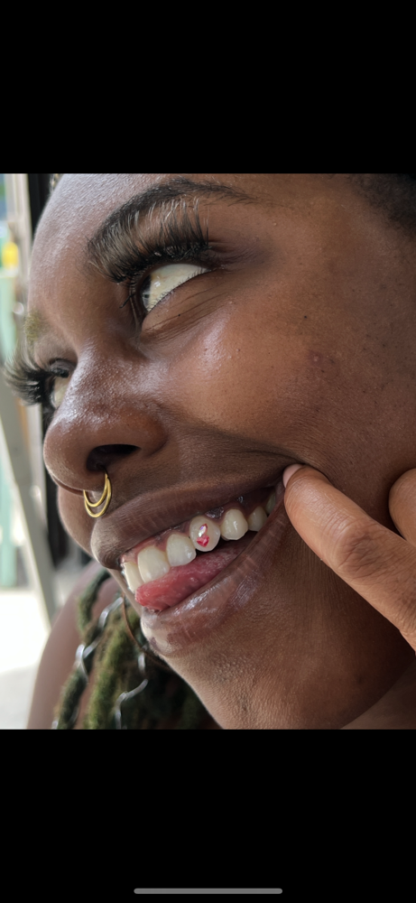 Teeth Gems