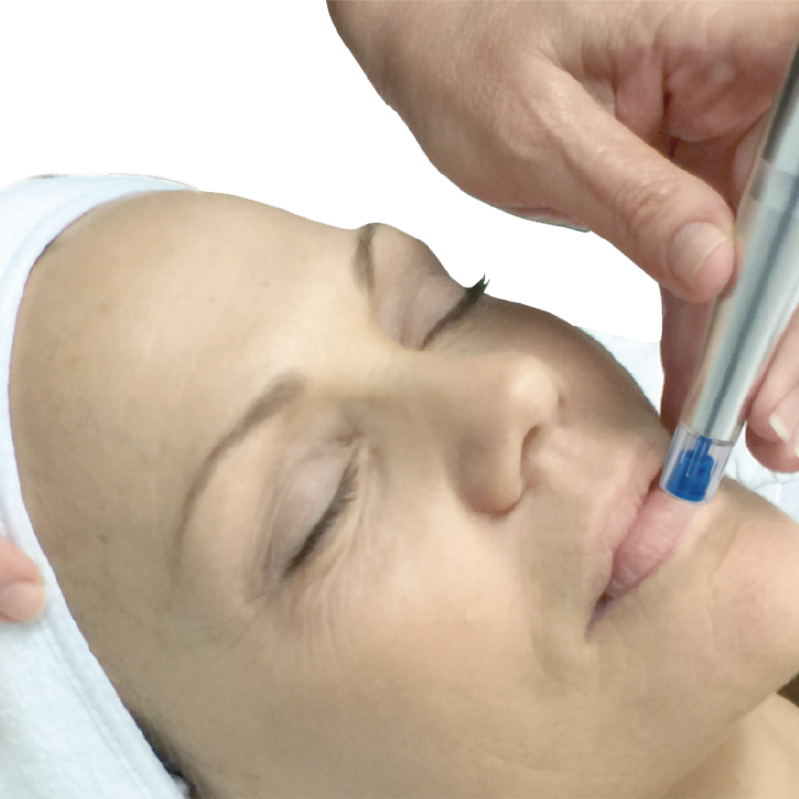 NANO Lip Renewal Add-on at SUSH Skin Studio And Spa in Covington, WA