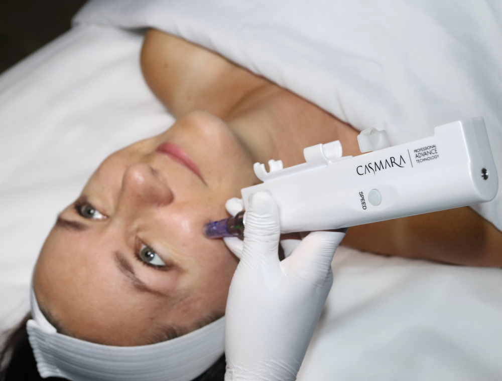 Microneedling  Treatment