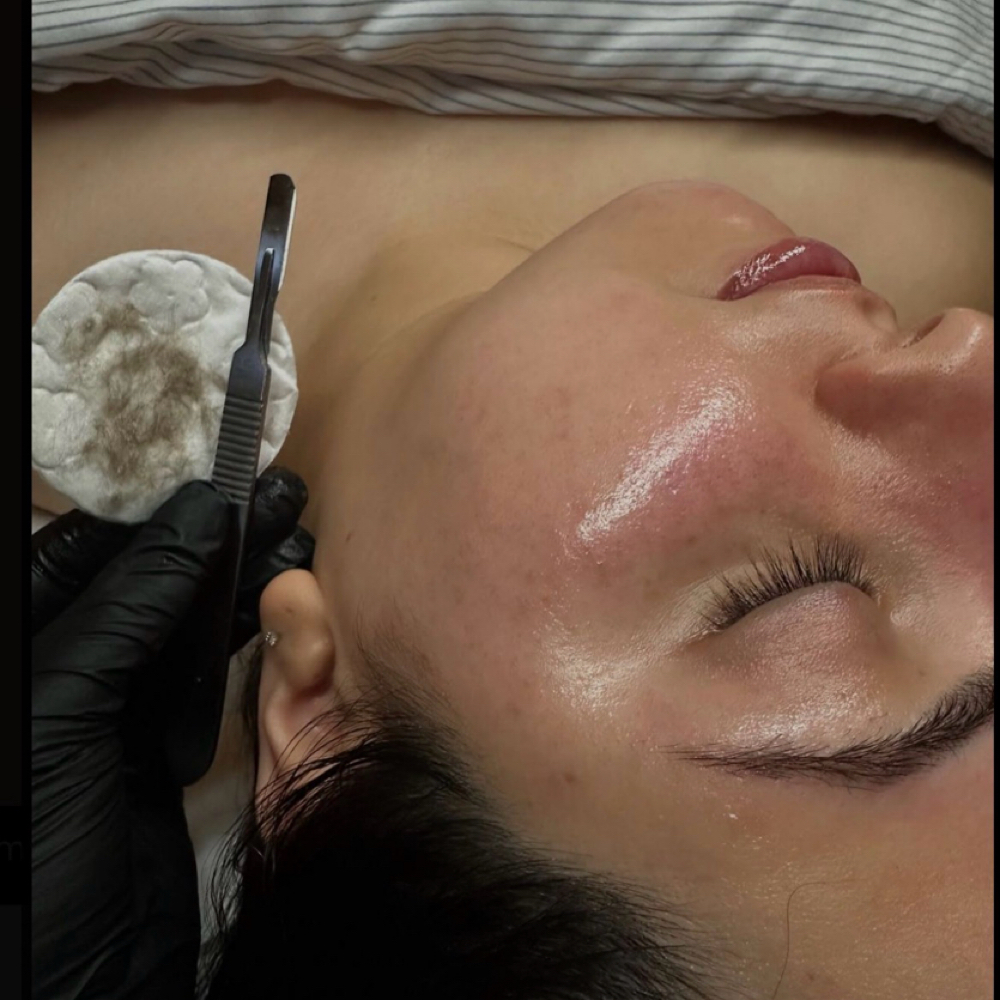 Dermaplane at Face It By Destiny, LLC in Heath, OH