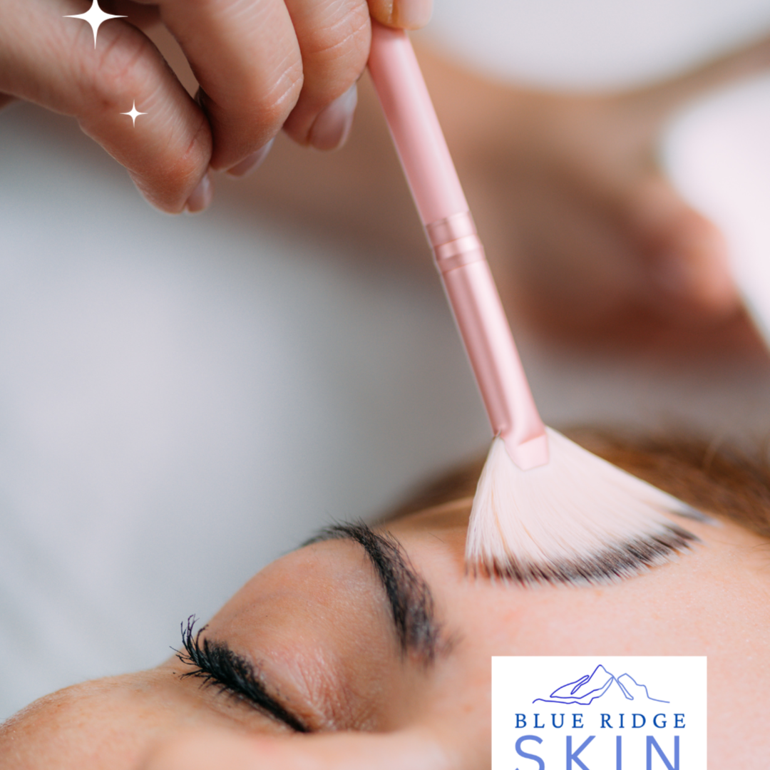 VI Chemical Peel at Blue Ridge Skin in staunton, VA