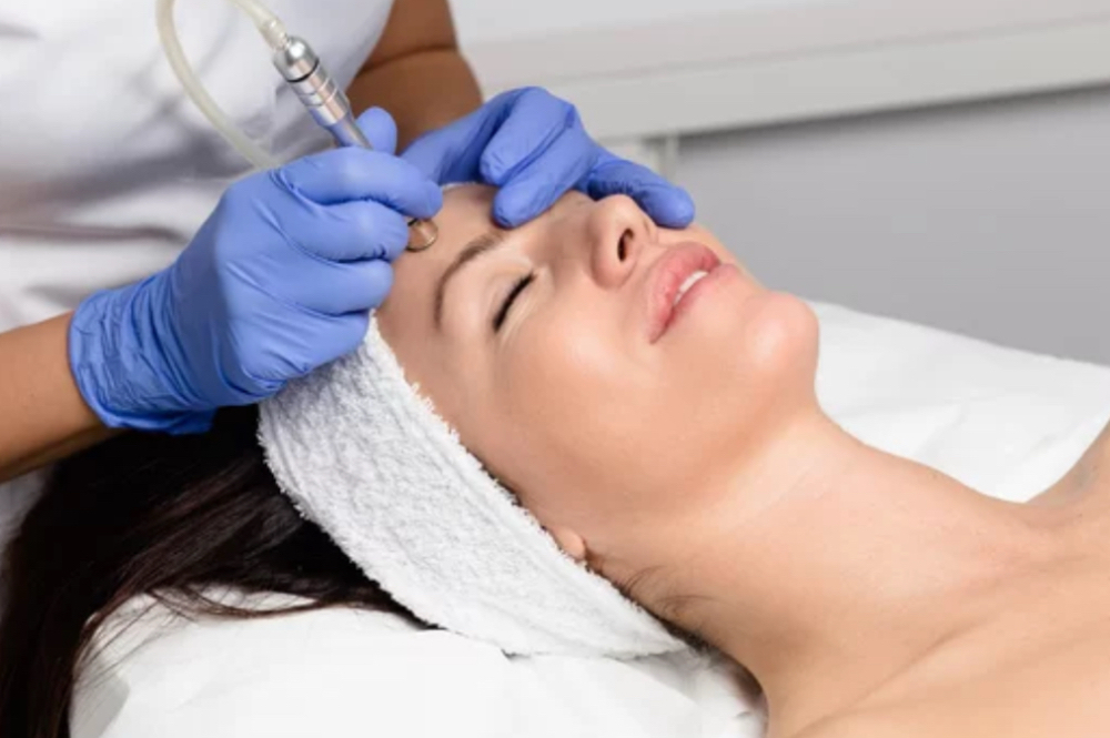 Microdermabrasion (Add-On)