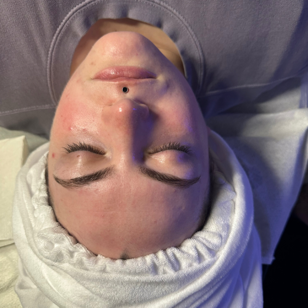 The Plush “Botox” Facial at Plush Luxe Aesthetic Lounge & Skin Clinic in Madison, TN