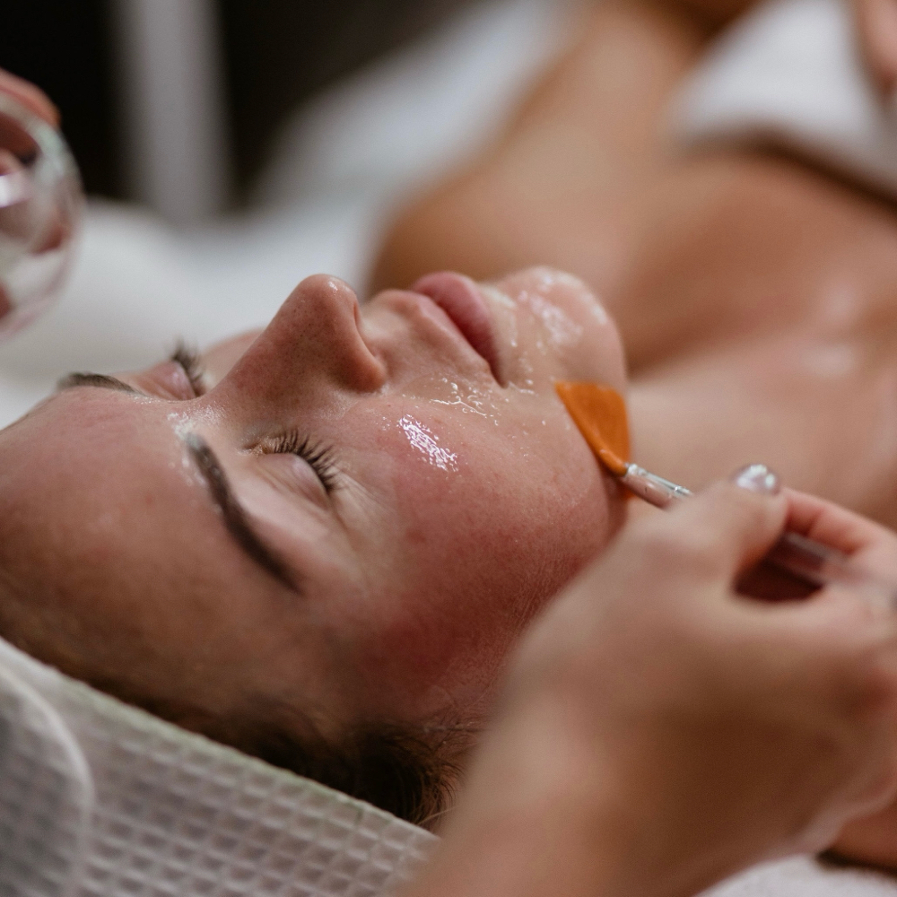ACNE FACIAL