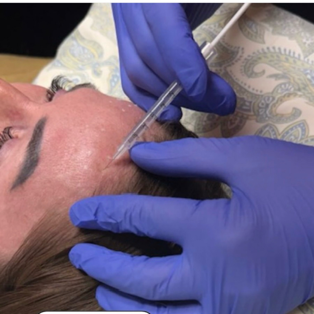 Botox at Gracefully Refined Aesthetics in Payette, ID