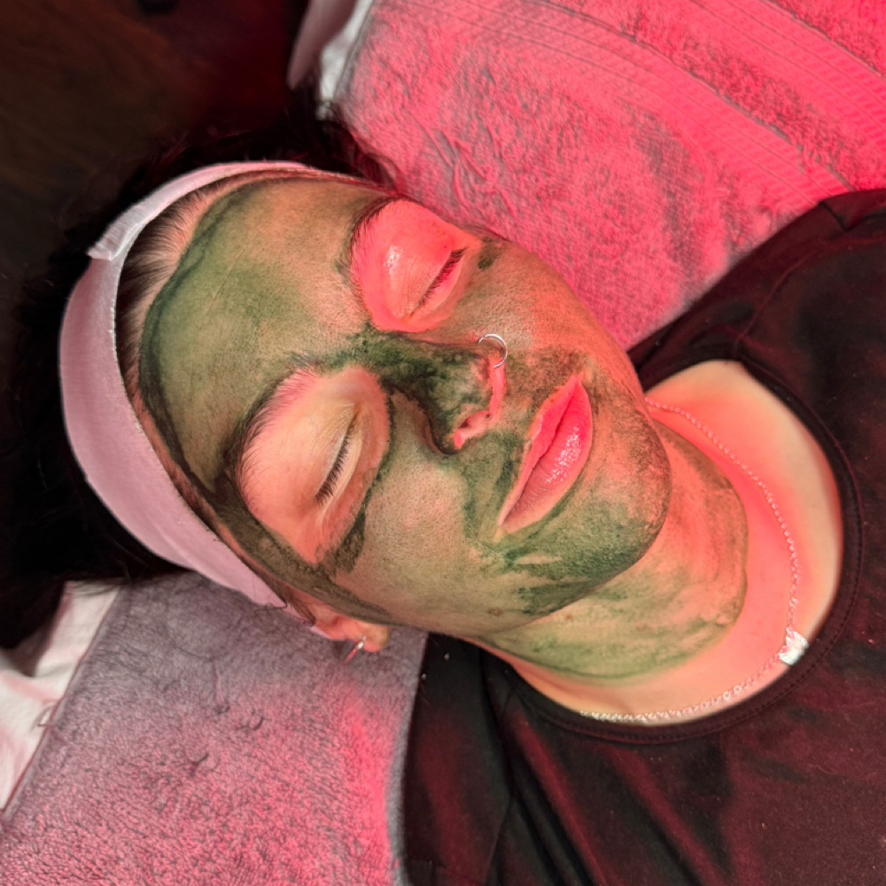Liqiud Microneedling at Studio Selah Aesthetics in Beacon, NY