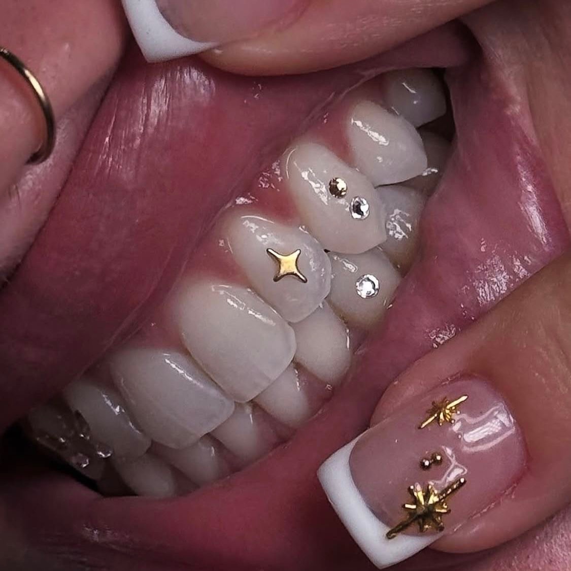 Tooth Gems at Skin Blvd in houston, TX
