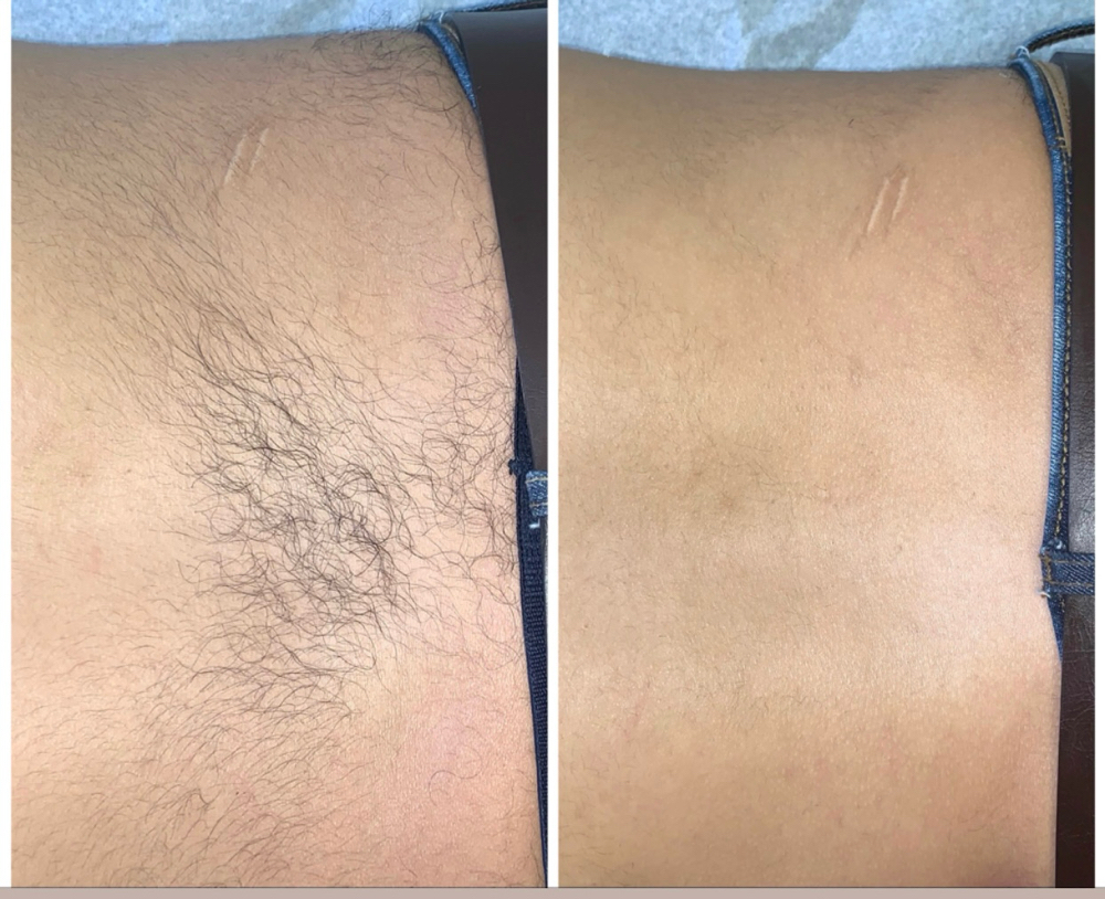 Lower Back Wax ($35)
