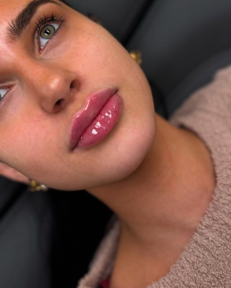 Full Lips/ Labios Relleno completo