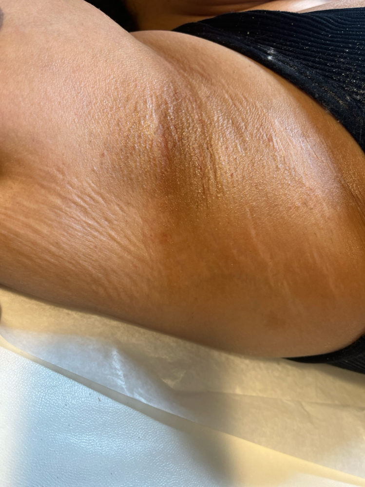 Underarm Wax