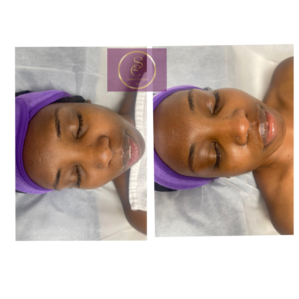 BASIC GLOW SKIN TREATMENT