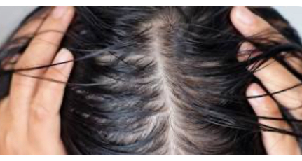 Oily Scalp Detox Treatment