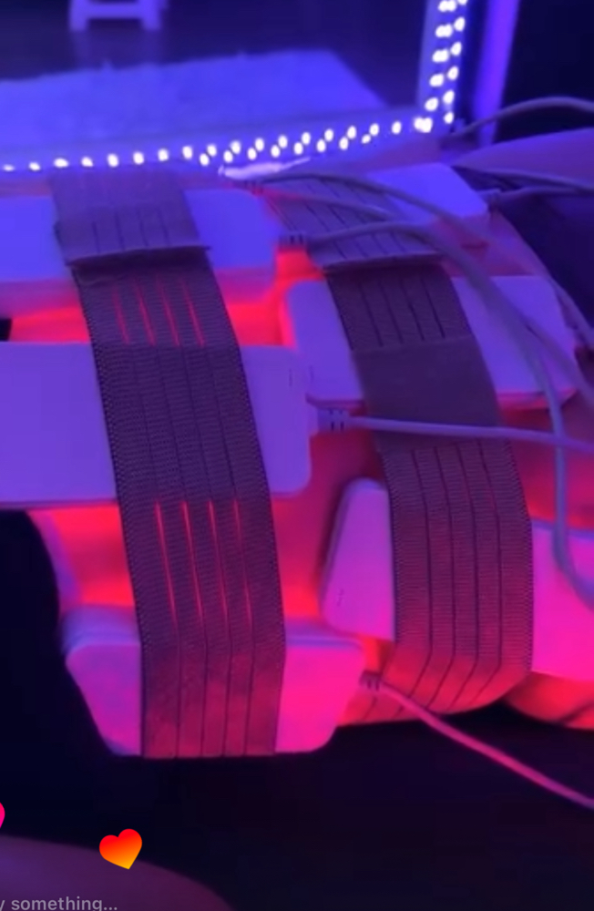 Laser Lipo