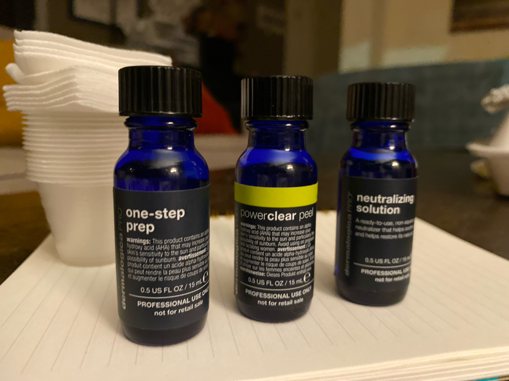 TCA Peel at Pamper Me Prettee Facials & Hair in Long Beach, CA