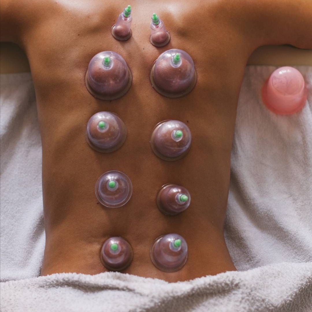 Cupping Therapy (Add-On) at Sculpted Therapeutics in South St Paul, MN