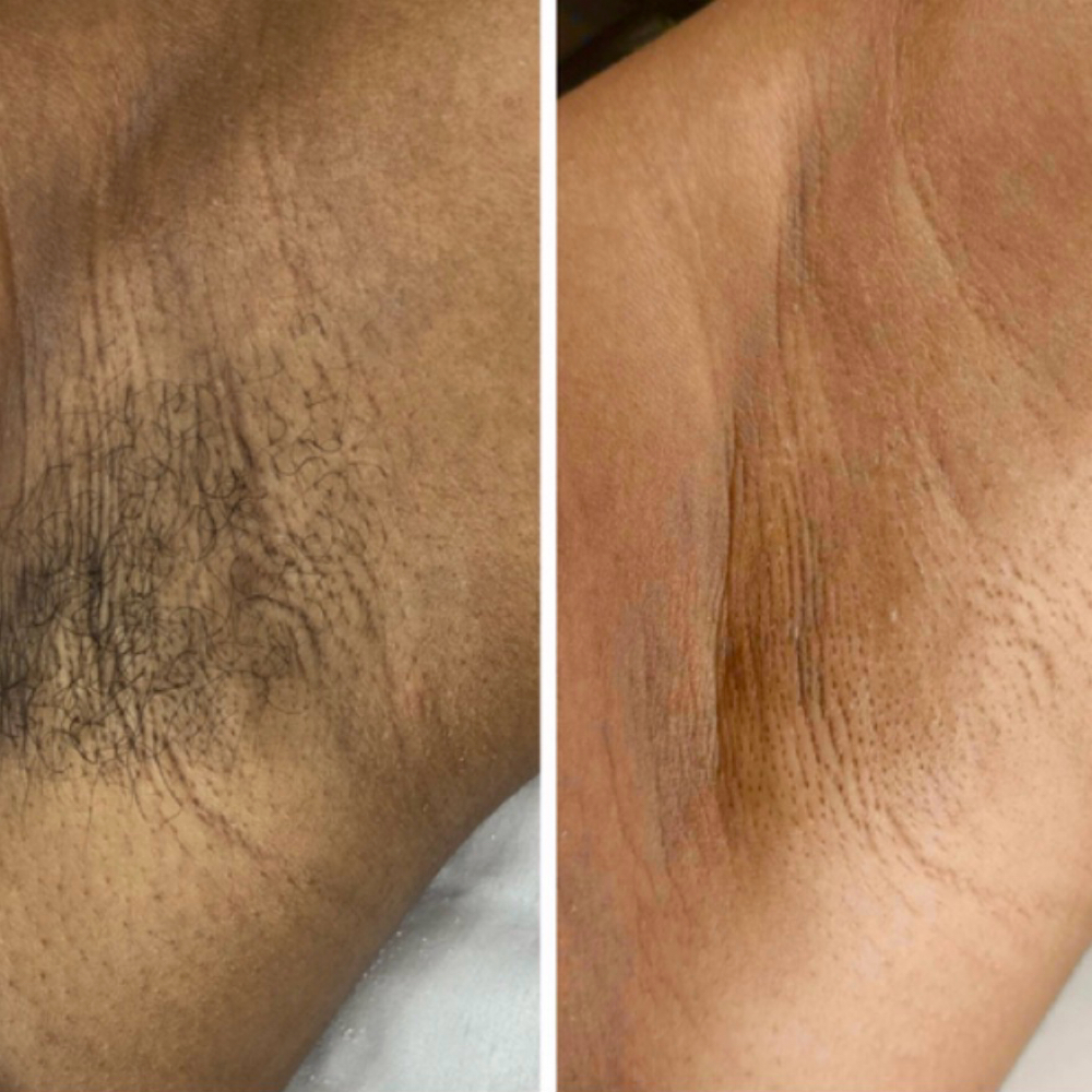 Armpit Wax at Lujean La’Shay in Rock Hill, SC