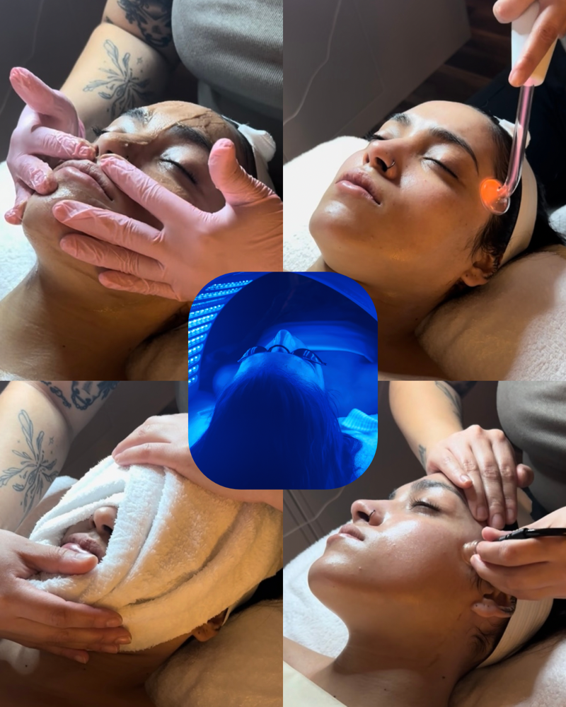 The It Girl Facial