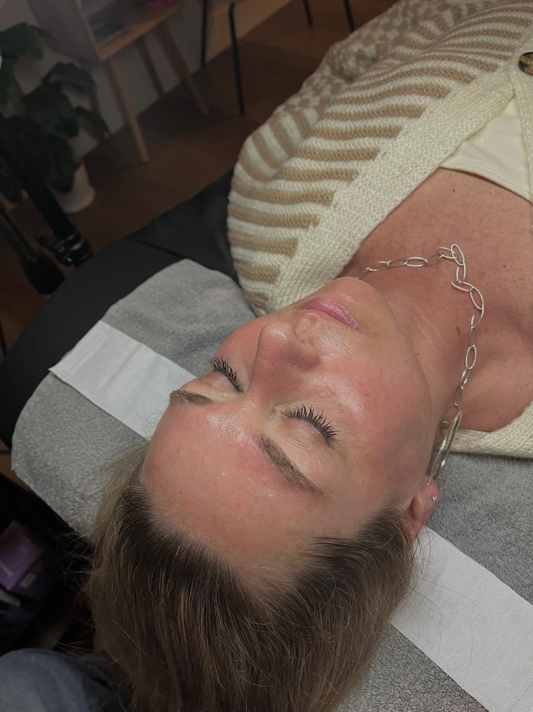 Dermaplane Add On