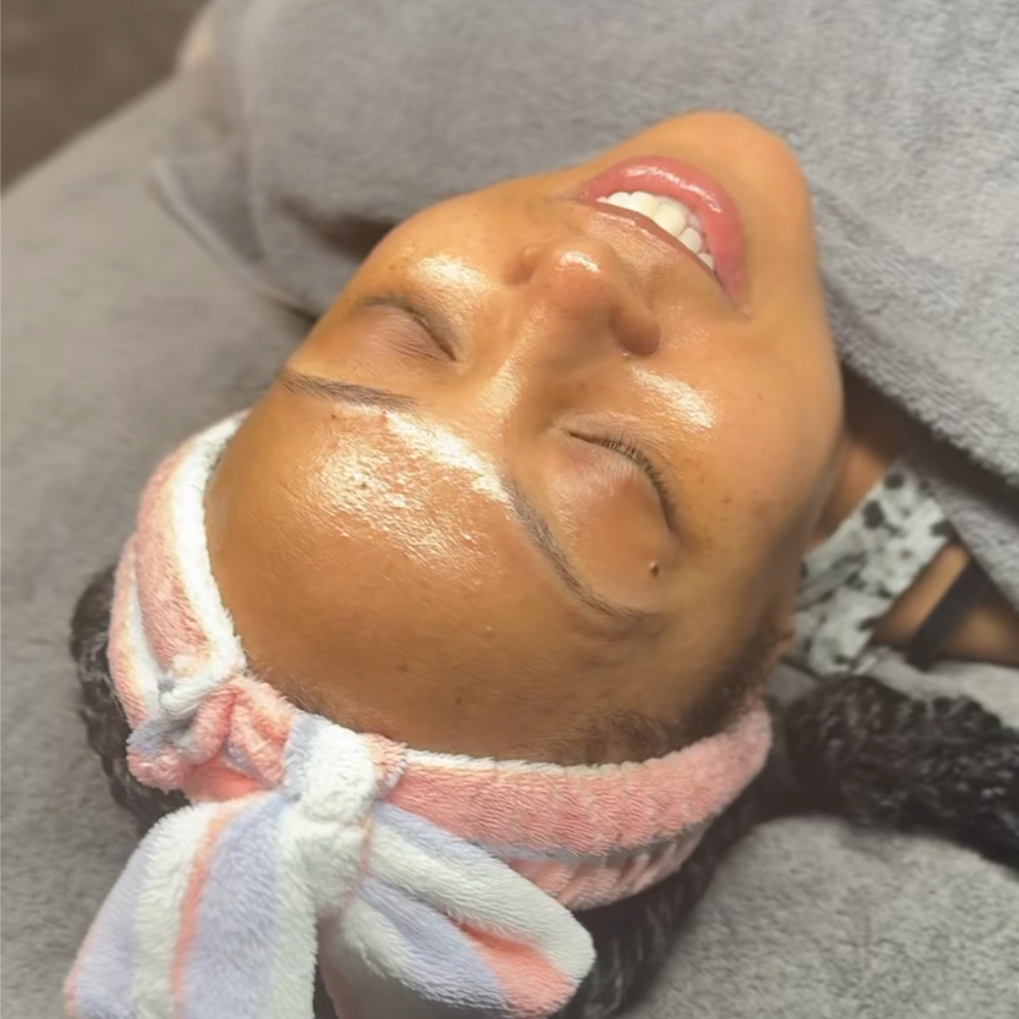 ACNE BOOTCAMP (CLEAR SKIN PROGRAM) at Beautiquè by Blanche in Charlotte, NC
