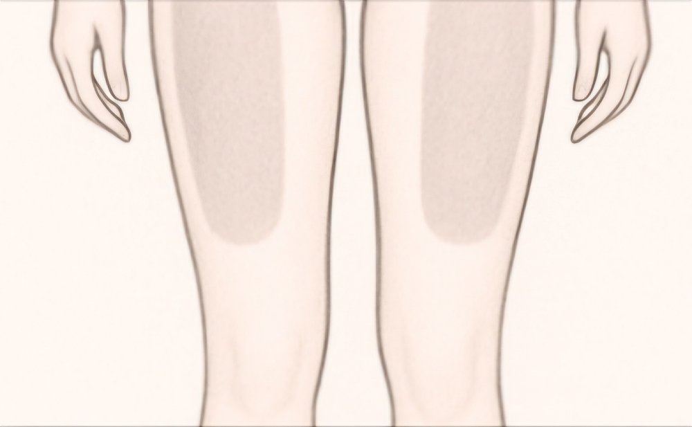 Upper Legs