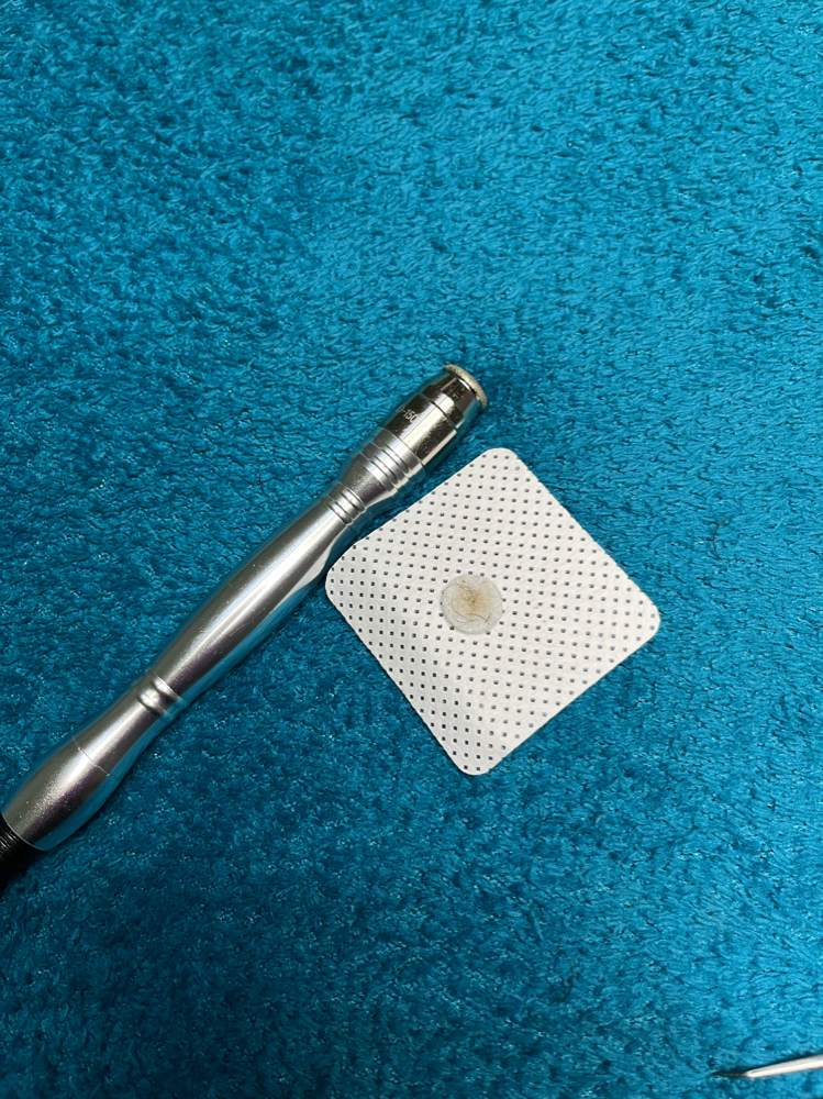 Microdermabrasion ONLY