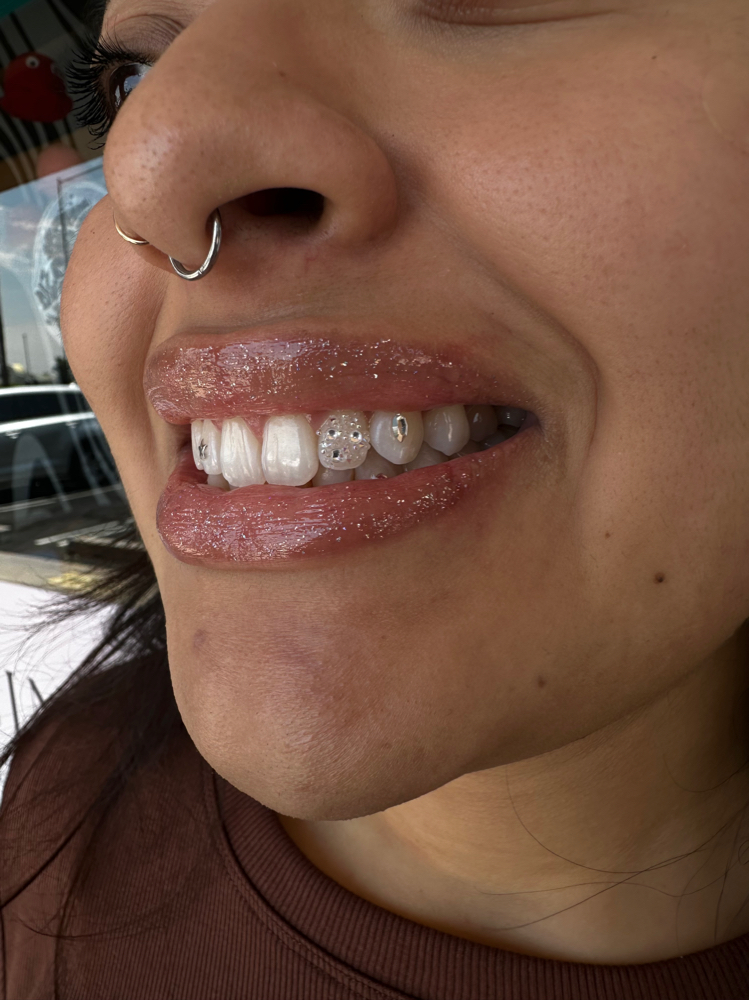 Pixie Chandelier Tooth Gems